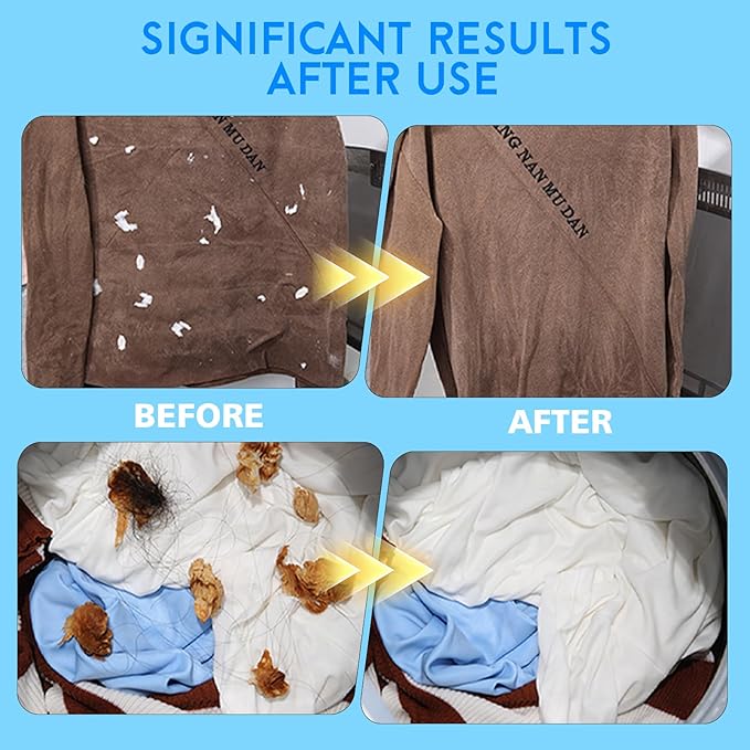 2026 Upgraded Pet Hair Remover for Laundry, Lint Catcher for Washing Machines, Laundry Pet Hair Catcher, Cat and Dog Hair Washing Machine Catcher 3PCS，for Use with Top-Loading Washing Machines；
